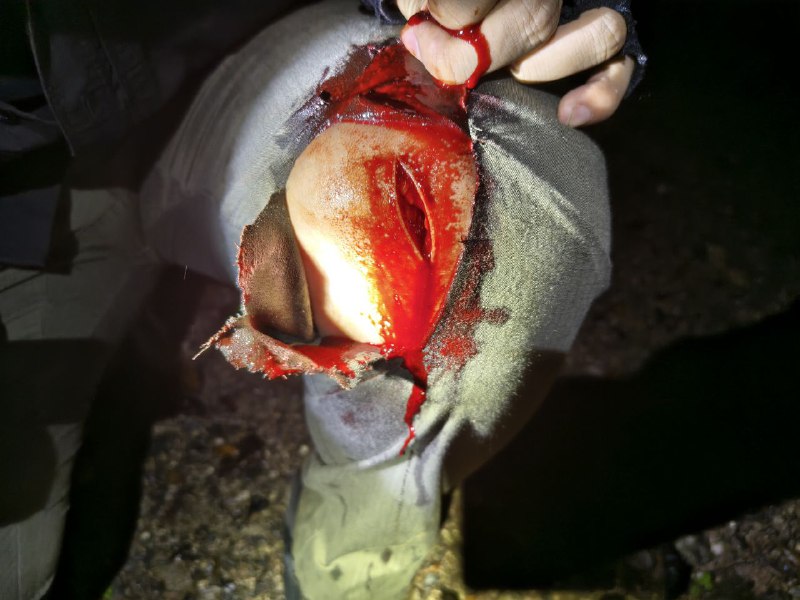 玩刀需谨慎，朋友们