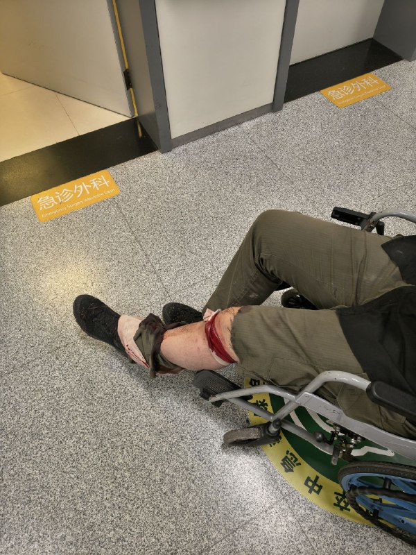 玩刀需谨慎，朋友们